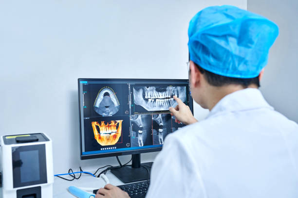 Best Emergency Tooth Extraction in Beverly Hills, FL