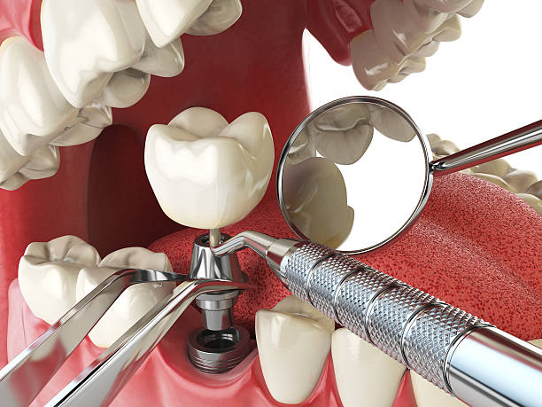 Best Emergency Dental Care for Trauma or Injury in Beverly Hills, FL